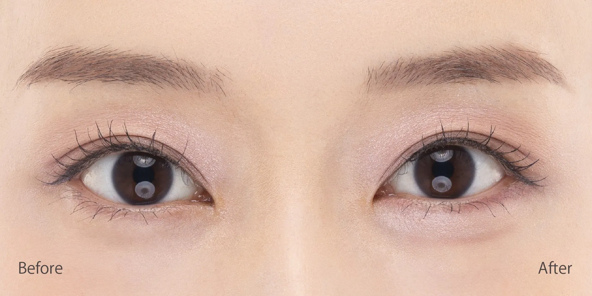 アンダーアイライナー Before After