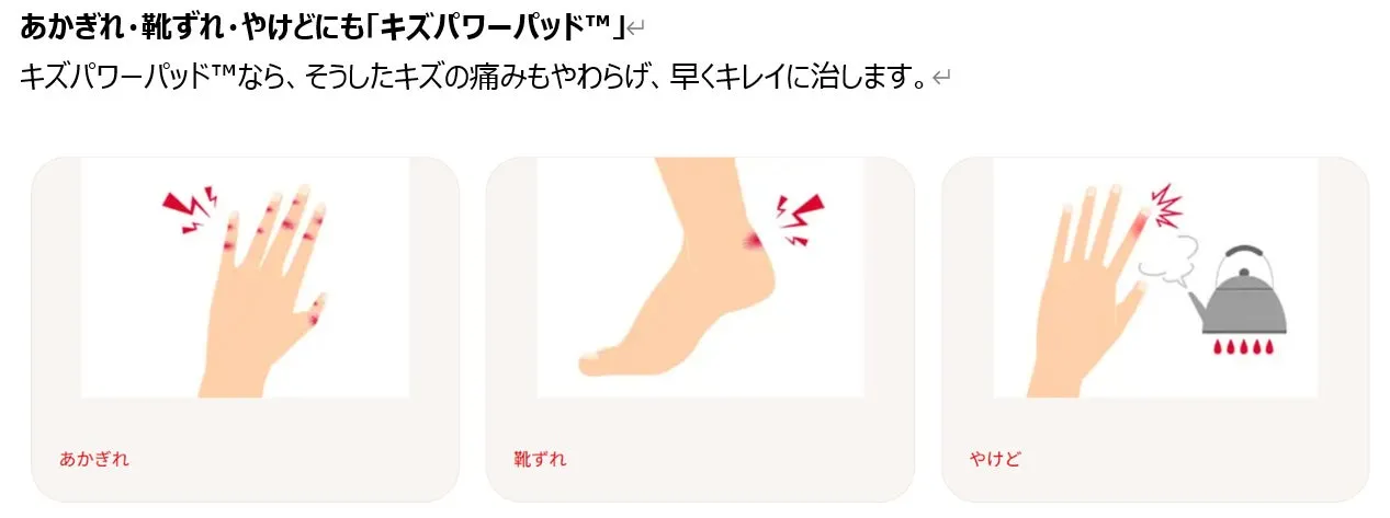 キズパワーパッドの広告画像。あかぎれ、靴ずれ、やけどのイラストが描かれている。